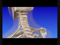 درمان درد گردن