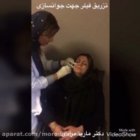 تزریق فیلر برای از بین بردن چین و چروک پوست