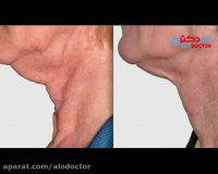 معرفی خدمات زیبایی ارائه شده در گروه لیزر برنا