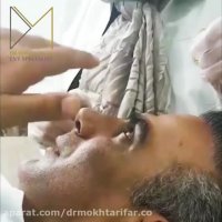 فیلم واقعی جراحی بینی گوشتی