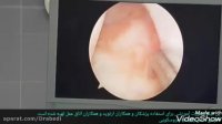 فیلم آموزشی جهت رزیدنتهای ارتوپدی