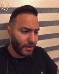 فیلم کاشت مو کلینیک تخصصی رنسانس