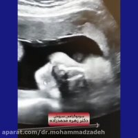 فیلم سونوگرافی پسر در 28 هفتگی