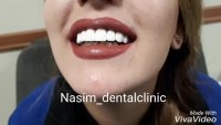 درمانگاه دندانپزشکی نسیم قیطریه - دندانپزشکی زیبایی – ارتودنسی – ایمپلنت – ونیرکامپوزیت – کاشت دندان – اصلاح طرح لبخند – لمینت دندان – لمینت سرامیکی