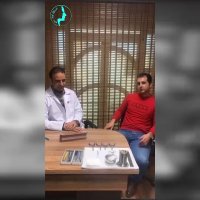 رضایت بیمار از عمل بینی خود توسط دکتر گلی