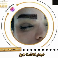 کاشت ابرو طبیعی | کلینیک آیتک | 44221324-021