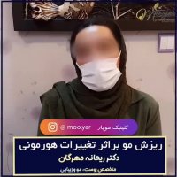 ریزش مو ناشی از تغییرات هورمونی