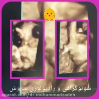 تصویر چهار بعدی صورت جنین