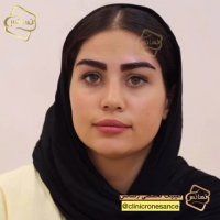 کاشت ابرو طبیعی