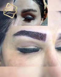 فیلم کاشت ابرو