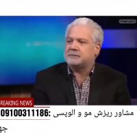 داروهای درمان ریزش مو سر و ریزش مو سکه ای چیست؟