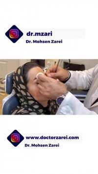 اموزش نحوه ی صحیح چسب زدن بینی