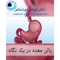 فیلم نحوه بالن معده