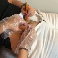 انجام کربوکسی تراپی  و جوان سازی و زیبا سازی پوست قسمت 1