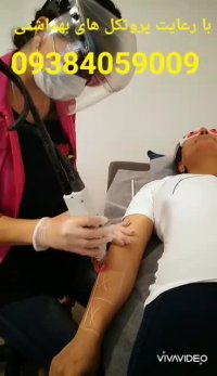 لیزر الکس کندلا منطقه تجریش  نیاوران 09384059009