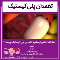 مشکلات تنبلی تخمدان