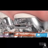 بهترین متخصص ارتودنسی