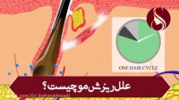 با علل ریزش مو آشنا شوید