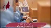 فیلم موارد بکارگیری آر اف فراکشنال و انواع آن - پارت 1