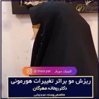 ریزش مو ناشی از نوسانات هورمونی
