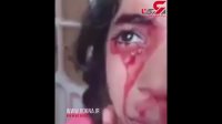 دختری که از  گوش‌ها و بینی اش خون گریه می‌کند