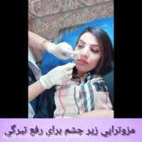 مزوتراپی زیر چشم‌برای رفع تیرگی