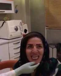 اصلاح طرح لبخند | دکتر ندا هادی دندانپزشک زیبایی و ترمیمی