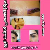 نمونه های کاشت ابرو | کلینیک آیتک | 44221324-021