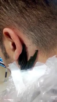 کلینیک طب سنتی تهران - زعفرانیه نحوه انجام زالو درمانی