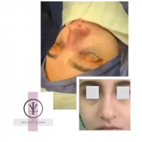 فیلم عمل انحراف بینی