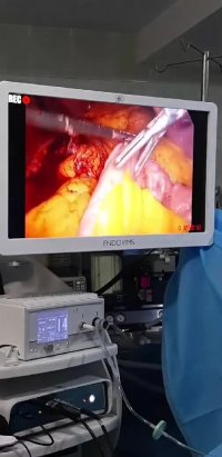 لایو اینستاگرام : مینی بای پس در خانم 32 ساله