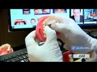 درمان ناهنجاری فک با اختراع دستگاه کوچک در دهان / متخصص ارتودنسی