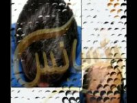 ترمیم مو به روش HRT  مرکز تخصصی مو رنسانس