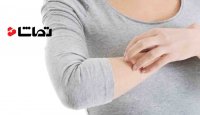 احساس خارش از کجا می آید؟
