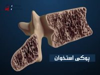 تقویت سیستم عضلانی و اسکلتی بدن