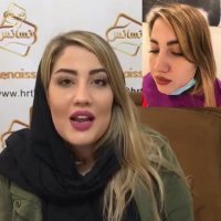 کاشت ابرو طبیعی در سعادت آباد