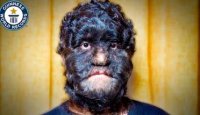 پشمالوترین مرد دنیا و دیگر رکوردهای عجیب گینس