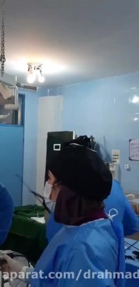 لایو اینستاگرام : جراحی اسلیو معده در آقای 41 ساله