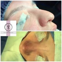 فیلم عمل بینی