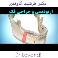 ارتودنسی و جراحی فک