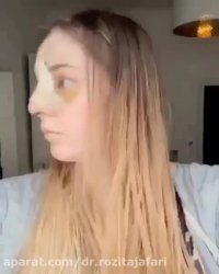 تحس الکدمات بعد جراحه الانف