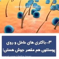 علت ایجاد جوش و روش های درمان آن