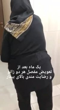 قبل و بعد از جراحی تعویض مفصل زانو