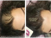 اسکالپ بسیار طبیعی قسمت هرلاین