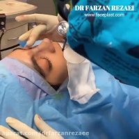 فیلم جراحی بینی گوشتی