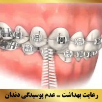 متخصص ارتودنسی | دکتر داودیان