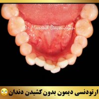 ارتودنسی غرب تهران | دکتر داوودیان
