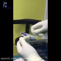 بازسازی رباط صلیبی