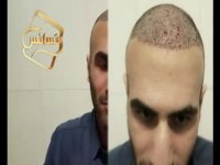 نظرات مراجعین مرکز تخصصی مو رنسانس