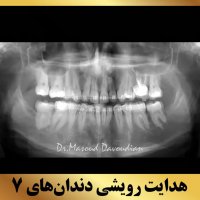 متخصص ارتودنسی | دکتر داودیان